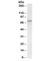 Western blot testing of A431 lysate with TP63 antibody at 0.3ug/ml