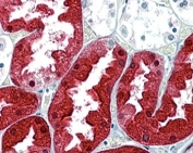 IHC staining of FFPE human kidney with Argininosuccinate synthetase 1 antibody at 2.5ug/ml. HIER: steamed with pH6 citrate buffer, AP-staining.