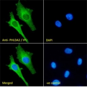 IF/ICC staining of fixed and permeabilized human HeLa cells with PHLDA2 antibody (green) at 10ug/ml and DAPI nuclear stain (blue).
