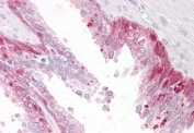 IHC testing of FFPE human prostate tissue with PHLDA2 antibody at 4ug/ml. HIER: steamed with pH6 citrate buffer, AP-staining.