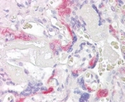 IHC testing of FFPE human placental tissue with PHLDA2 antibody at 4ug/ml. HIER: steamed with pH6 citrate buffer, AP-staining.