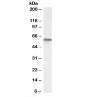 Western blot testing of human lung lysate with VDBP antibody at 1ug/ml. Predicted molecular weight: ~53kDa.