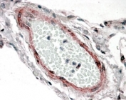 IHC staining of FFPE human lung with CSRP2 antibody at 3.8ug/ml. HIER: steamed with pH6 citrate buffer, AP-staining.