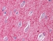 IHC testing of FFPE human cerebral cortex with ICAM5 antibody at 2.5ug/ml. HIER: steamed with pH6 citrate buffer, AP-staining.