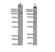 Western blot testing of human A) ThP1 and B) A549 cell lysate with MERTK antibody at 3.5ug/ml. Predicted molecular weight: 110~205 kDa depending on glycosylation level.