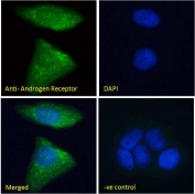 IF/ICC staining of fixed and permeabilized human MCF7 cells with Androgen receptor antibody (green) at 10ug/ml and DAPI nuclear stain (blue).
