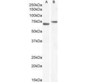Western blot testing of human A) HeLa and B) Caco-2 cell lysate with NOX5 antibody. Predicted molecular weight: ~86 kDa.