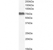 Western blot testing of human adrenal gland tissue lysate with NOX5 antibody. Predicted molecular weight: ~86 kDa.