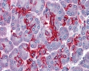 IHC testing of FFPE human pancreas tissue with ABHD5 antibody at 3.75ug/ml. Required HIER: steamed antigen retrieval with pH6 citrate buffer; AP-staining.