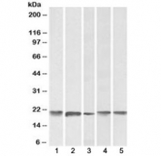Western blot testing of human 1) cerebellum, 2) liver, 3) placenta, 4) mouse brain and 5) rat brain lysate with FTL antibody at 0.1ug/ml. Predicted molecular weight: ~20 kDa.