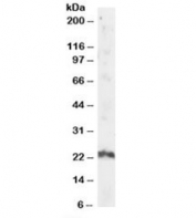 Western blot testing of human testis lysate with ARL4A antibody at 2ug/ml. Predicted/observed molecular weight: ~23kDa.