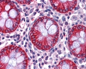 IHC testing of FFPE human colon tissue with NDRG1 antibody at 2.5ug/ml. Required HIER: steamed antigen retrieval with pH6 citrate buffer; AP-staining.