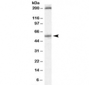 Western blot testing of human colon lysate with Serotonin receptor 3A antibody at 0.3ug/ml. Both the expected 55 kDa band and the additional ~200 kDa band block with the addition of immunzing peptide.
