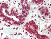 IHC testing of FFPE human breast tissue with NUR77 antibody at 5ug/ml. Steamed antigen retrieval with citrate buffer pH 6, AP-staining.