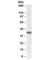 Western blot testing of human duodenum lysate with Calponin 3 antibody at 0.3ug/ml. Predicted molecular weight: ~36kDa.