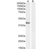 Western blot testing of human cerebellum tissue lysate in the absence (A) and presence (B) of immunizing peptide, with RCAN1 antibody.