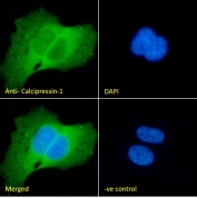 IF/ICC staining of fixed and permeabilized human U-2 OS cells with RCAN1 antibody (green) at 10ug/ml and DAPI nuclear stain (blue).