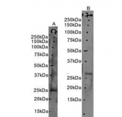 Western blot testing of human A) bone marrow and B) spleen tissue lysate with Proteinase 3 antibody. Predicted molecular weight ~28 kDa.