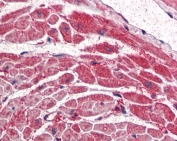 IHC testing of FFPE human heart with PI3K antibody at 5ug/ml. HIER: steamed with pH6 citrate buffer, AP-staining.