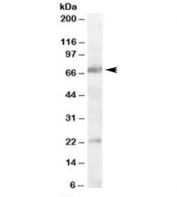 Western blot testing of rat brain lysate with CHRNA4 antibody at 0.3ug/ml. Predicted/observed molecular weight: ~70kDa. Both observed bands are blocked by addition of immunizing peptide.