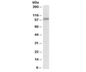 Western blot testing of peripheral blood lymphocyte lysate with IL12RB1 antibody at 0.3ug/ml. Predicted molecular weight: ~73/100kDa (unmodified/glycosylated).