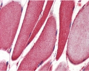 IHC testing of FFPE human skeletal muscle tissue with ALOX15 antibody at 2ug/ml. Required HIER: steamed antigen retrieval with pH6 citrate buffer; AP-staining.