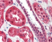 IHC testing of FFPE human kidney tissue with ALOX15 antibody at 2ug/ml. Required HIER: steamed antigen retrieval with pH6 citrate buffer; AP-staining.