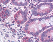 IHC testing of FFPE human small intestine tissue with ACSL4 antibody at 3.75ug/ml. Required HIER: steamed antigen retrieval with pH6 citrate buffer; AP-staining.