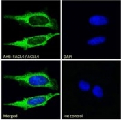 Immunofluorescent staining of fixed and permeabilized human HeLa cells with ACSL4 antibody (green) at 10ug/ml and DAPI nuclear stain (blue).