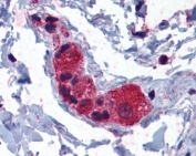 IHC testing of FFPE human colon tissue with MYRIP antibody at 3.75ug/ml. Required HIER: steamed antigen retrieval with pH6 citrate buffer; AP-staining.