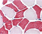 IHC testing of FFPE human skeletal muscle tissue with EBAG9 antibody at 3.75ug/ml. Required HIER: steamed antigen retrieval with pH6 citrate buffer; AP-staining.