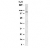 Western blot testing of human spleen lysate with OSBPL5 antibody at 0.2ug/ml. Predicted molecular weight: ~98 kDa, observed here at ~110 kDa.