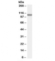 Western blot testing of human spleen lysate with OSBPL5 antibody at 2ug/ml. Predicted molecular weight: ~98 kDa, observed here at ~110 kDa.