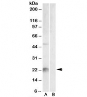 Western blot testing of mouse liver lysate with Kallikrein 6 antibody at 2ug/ml with [B] and without [A] blocking/immunizing peptide. Predicted molecular weight: ~27kDa.