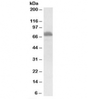 Western blot testing of rat thymus lysate with ITK antibody at 0.3ug/ml. Predicted molecular weight: ~72kDa.