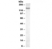 Western blot testing of mouse liver lysate with Pyruvate Carboxylase antibody at 0.03ug/ml. Predicted molecular weight: ~130 kDa, observed here at 140~150 kDa.