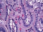IHC testing of FFPE human intestinal tissue with Netrin 1 antibody at 3.75ug/ml. Required HIER: steamed antigen retrieval with pH6 citrate buffer; AP-staining.