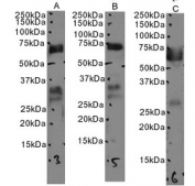 Western blot testing of human A) duodenum, B) lung and C) lung tissue lysate with CD74 antibody. Expected molecular weight: 33-43 kDa.