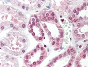 IHC testing of FFPE human kidney tissue with TGM7 antibody at 5ug/ml. Required HIER: steamed antigen retrieval with pH6 citrate buffer; AP-staining.