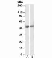 Western blot testing of human albumin-depleted plasma [A] and serum [B] lysates with PEDF antibody at 0.3ug/ml. Predicted molecular weight: ~46kDa.