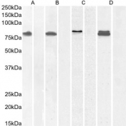 Western blot testing of A) human K562 cell lysate without and with blocking peptide, B) human ThP-1 cell lysate without and with blocking peptide, C) human U-251 cell lysate without and with blocking peptide and D) rat KNRK cell lysate without and with blocking peptide, with IFT88 antibody.
