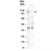 Western blot of HEK293 lysate overexpressing human EIF2C1/AGO1 and probed with AGO1 antibody (non-transfected HEK293 lysate in lane B). Predicted molecular weight: ~95kDa, observed here at ~110kDa.