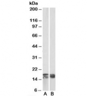 Western blot testing of human tonsil [A] and Jurkat [B] lysates with CD3 zeta antibody at 0.03ug/ml. Predicted molecular weight ~19 kDa but may be observed at higher molecular weights due to glycosylation.