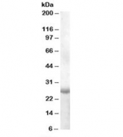 Western blot testing of human muscle lysate with APOBEC2 antibody at 1ug/ml. Predicted molecular weight: ~26kDa.