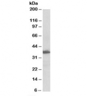 Western blot testing of human lymph node lysate with AIMP1 antibody at 0.1ug/ml. Predicted molecular weight: ~34/37kDa (isoforms 1/2).