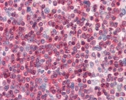 IHC testing of FFPE spleen tissue with CORO1A antibody at 3.75ug/ml. HIER: steamed antigen retrieval with pH6 citrate buffer; AP-staining.