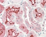 IHC testing of FFPE human kidney with KLK6 antibody at 5ug/ml. HIER: steamed with pH6 citrate buffer, AP-staining.