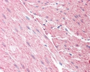IHC testing of FFPE human colon tissue with GRAF antibody at 3.75ug/ml. Required HIER: steamed antigen retrieval with pH6 citrate buffer; AP-staining.