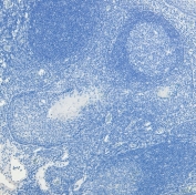 Negative control: IHC staining of FFPE human tonsil tissue without PRDM1 antibody. HIER: steamed with pH6 citrate buffer.