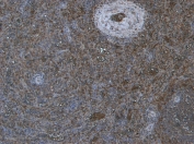 IHC staining of FFPE human tonsil tissue with PRDM1 antibody at 6ug/ml. HIER: steamed with pH6 citrate buffer, HRP-staining.